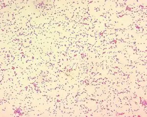 البروسيلا / الحمى المالطية / brucellosis Brucella_spp