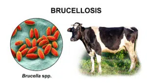 البروسيلا / الحمى المالطية / brucellosis