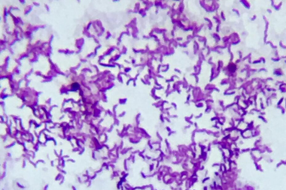 التسمم الدموي النزفي Hemorrhagic Septicemia